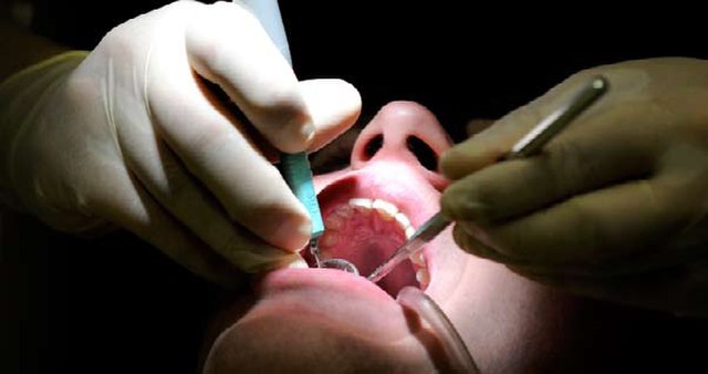 Solident38 : Des soins dentaires pour les plus démunis